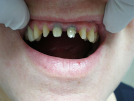 Dental case 3